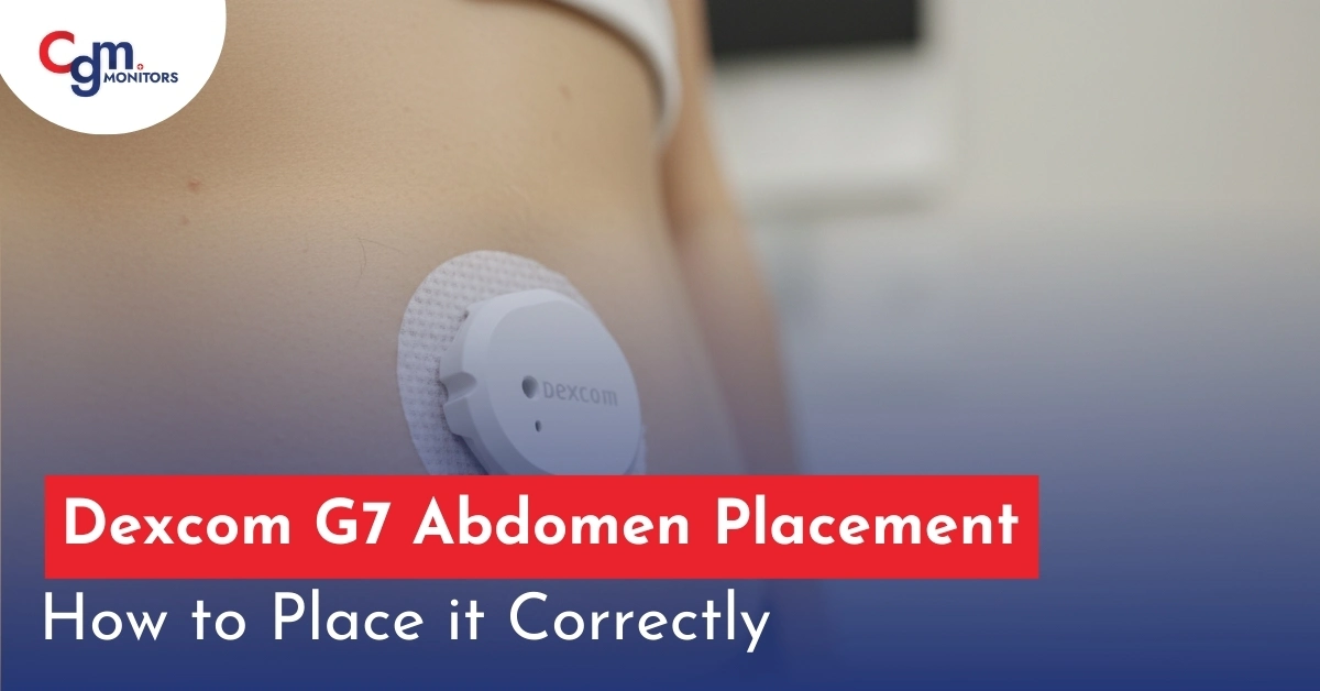 Dexcom G7 Abdomen Placement