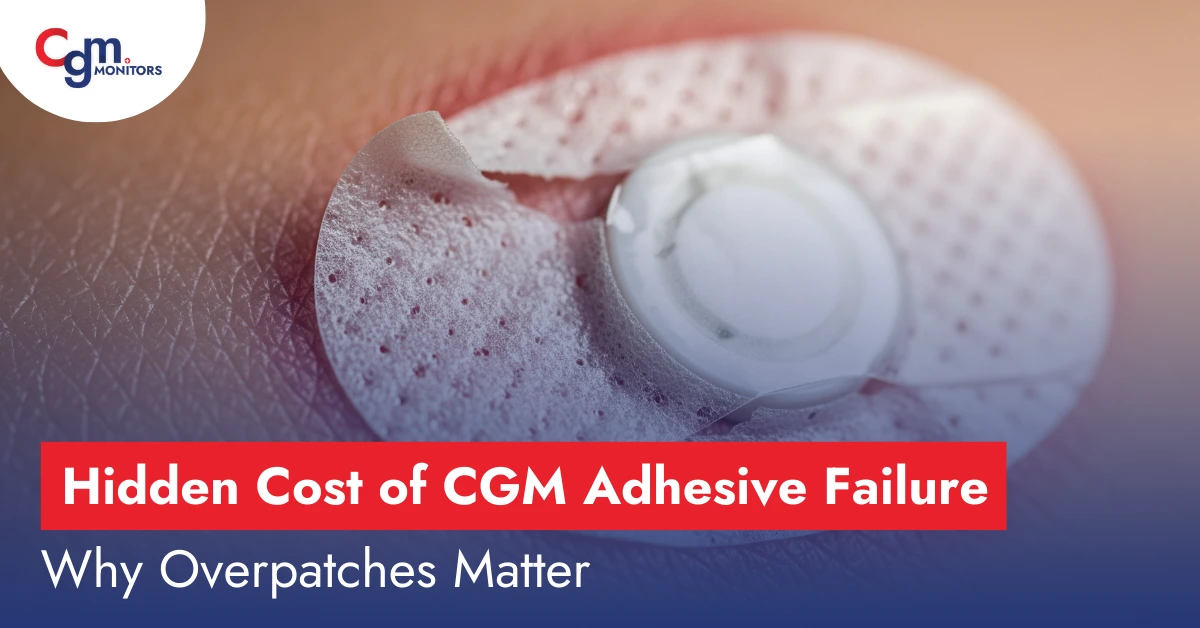 Hidden Cost of CGM Adhesive Failure