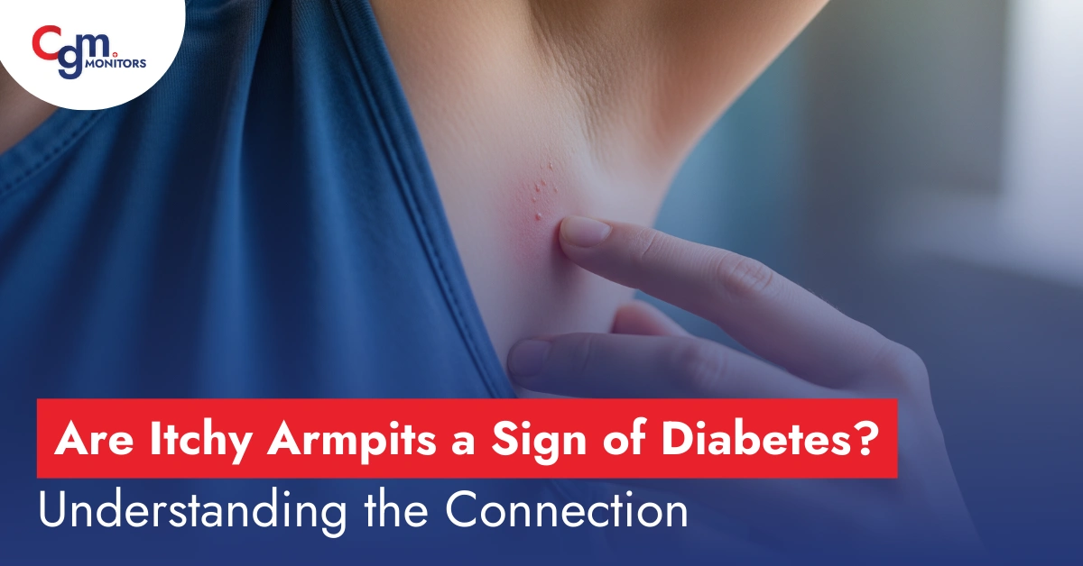 Are Itchy Armpits a Sign of Diabetes