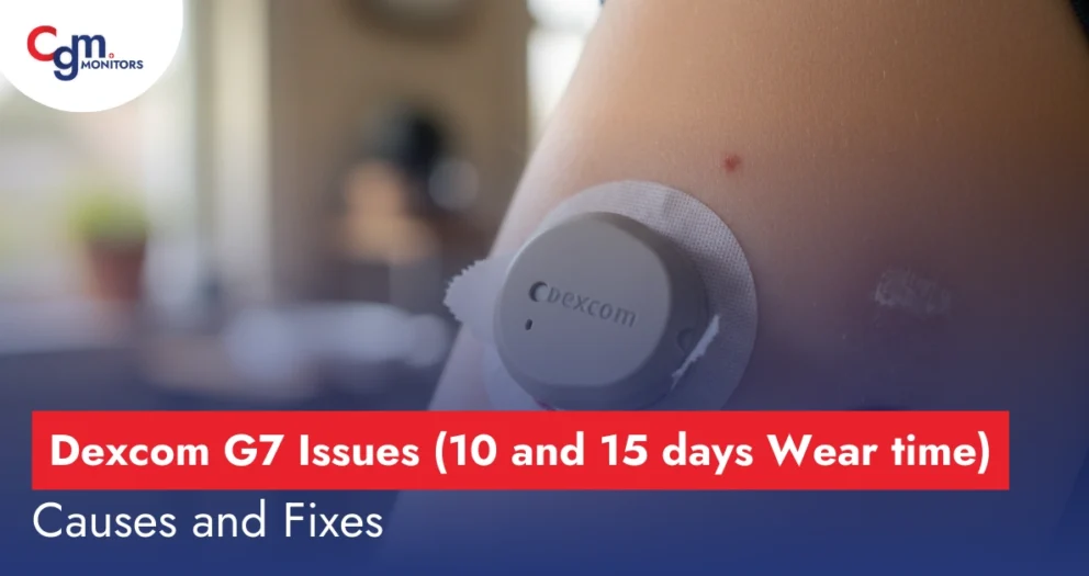 Dexcom G7 Issues
