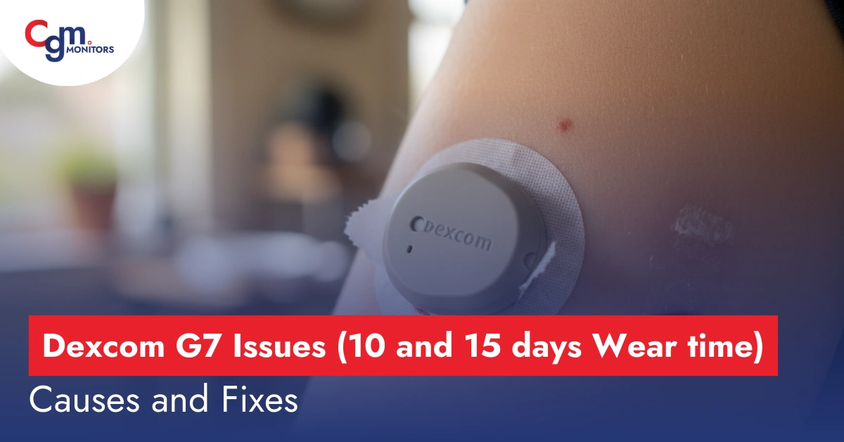 Dexcom G7 Issues
