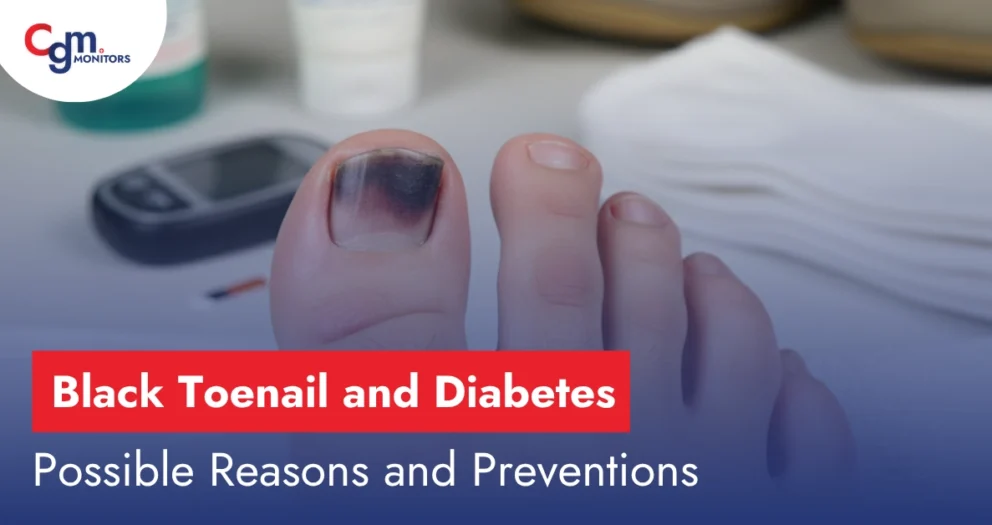 Black Toenail and Diabetes