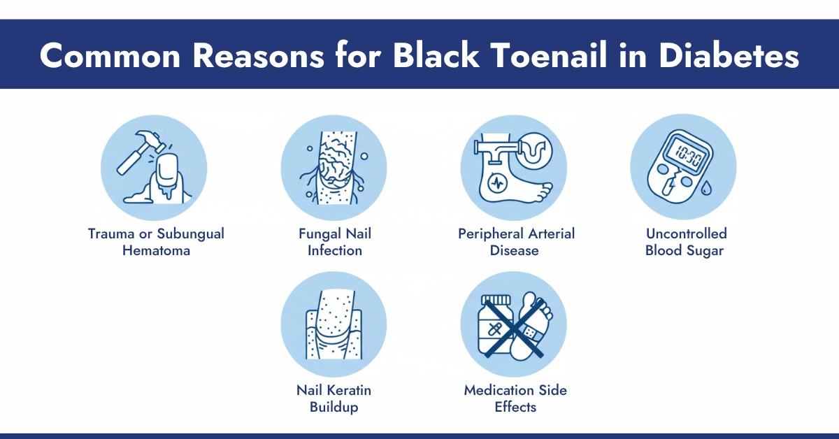 Common Reasons for Black Toenail in Diabetes