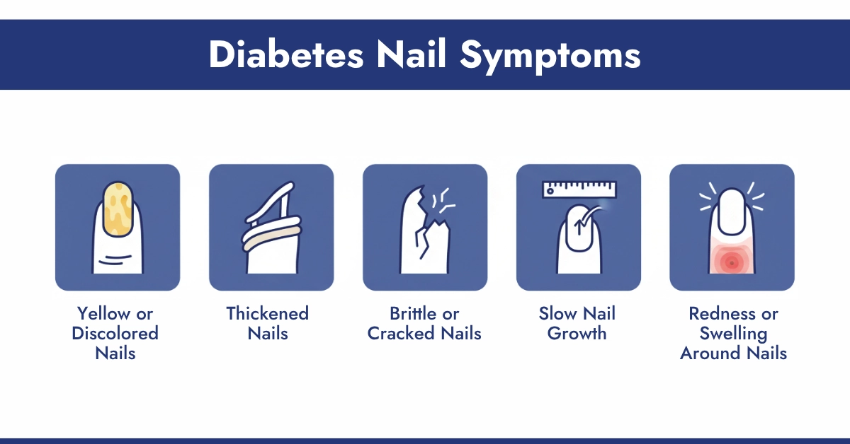 Diabetes Nail Symptoms