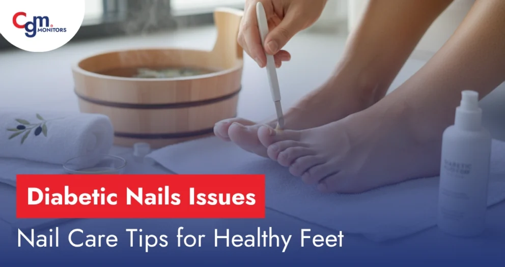 Diabetic Nails Issues