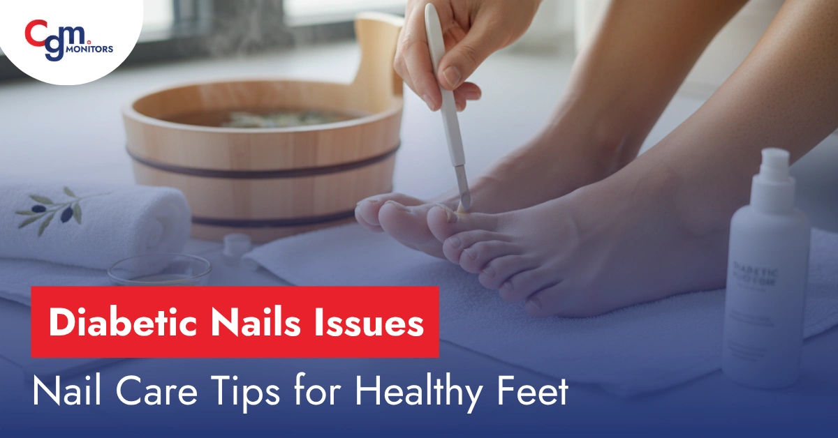Diabetic Nails Issues