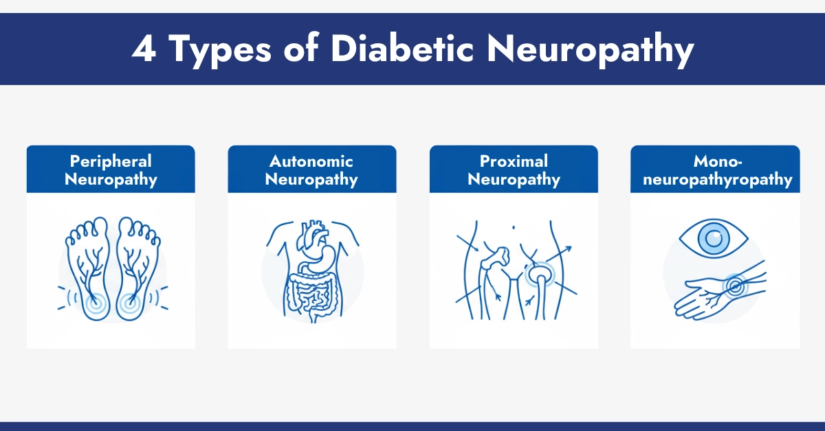 4 Types of Diabetic Neuropathy